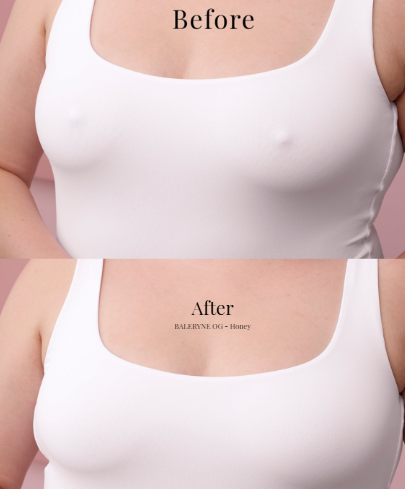 grippy BALERYNE circles™